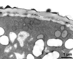 pollen wall, interapertural area