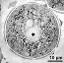 pollen grain in cross section, vegetative nucleus (asterisk) and generative cell