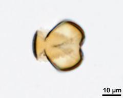 acetolyzed pollen, lower focus