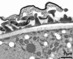 pollen wall; interapertural area