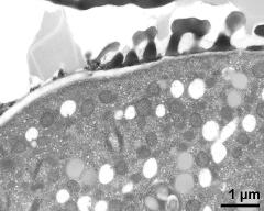 pollen wall, transition from aperture to interapertural area