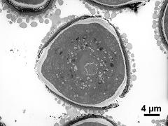 Overview showing tricolporate pollen grain in cross section,pollenkitt attached to pollen wall