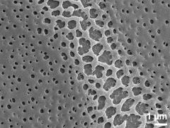 exine surface,equator