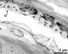 pollen wall (bottom) and tapetum cells with Ubisch bodies (U)