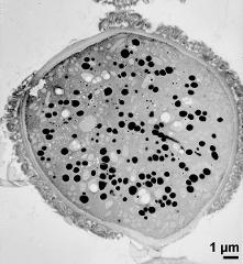 cross section of pollen grain