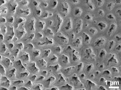 acetolyzed pollen,exine surface