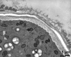 apertural area of pollen wall