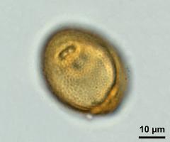 acetolyzed pollen,equatorial view