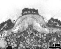 apertural area of pollen wall