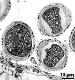 pollen grains and part of tapetum wall (bottom)