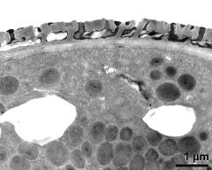 pollen wall, interapertural area