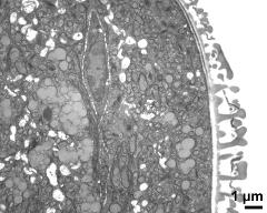 cytoplasm with sperm cell and lipids