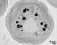 young pollen grain, apertures are covered by lipids