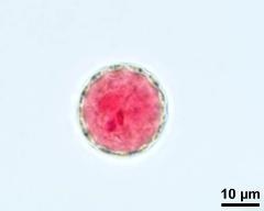 vegetative nucleus and sperm cells