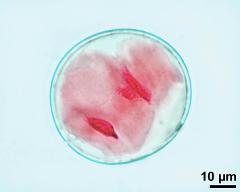 pollen grain with vegetative cell and two sperm cells