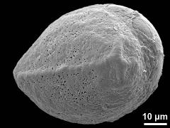 oblique proximal polar view