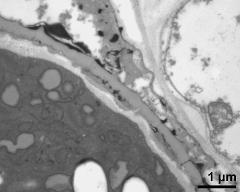 pollen wall, interapertural area, pollenkitt, Ubisch bodies