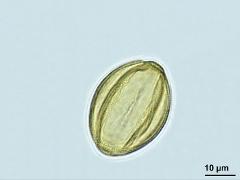 acetolyzed pollen,equatorial view