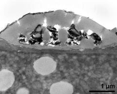 interapertural area of pollen wall