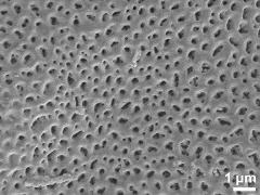 acetolyzed pollen,exine surface