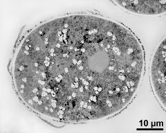 pollen grain in cross section