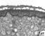 interapertural area of pollen wall