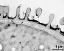 interapertural area of pollen wall, intine (I), endexine (E)