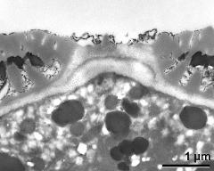 apertural area of pollen wall