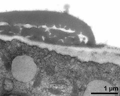 pollen wall, aperture area