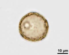 acetolysed pollen, optical section