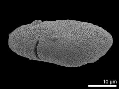 acetolyzed pollen,equatorial view