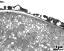 pollen wall at transition of aperture and interapertural area