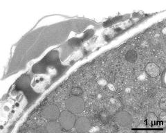 pollen wall, transition from aperture to interapertural area