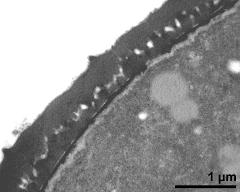 pollen wall, interapertural area, endexine clearly visible