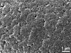 exine surface (saccus)