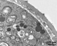 pollen wall, interapertural area