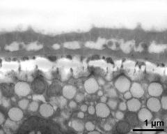 interapertural area of pollen wall