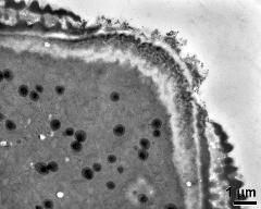 apertural area of pollen wall