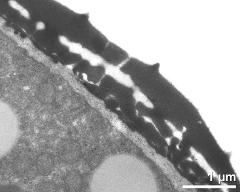 pollen wall, interapertural area