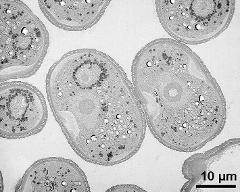 pollen grains in cross section