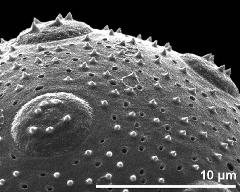 apertures and exine surface