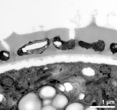 interapertural area of pollen wall