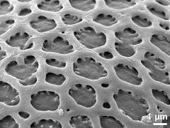 exine surface