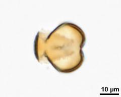 acetolyzed pollen, optical section