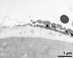 pollen wall at transition of aperture and interapertural area