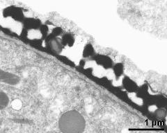 pollen wall, interapertural area