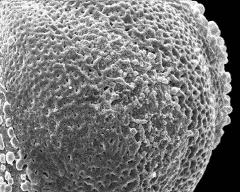 interapertural area of pollen grain