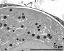 apertural area of pollen wall