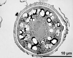 pollen grain in cross section