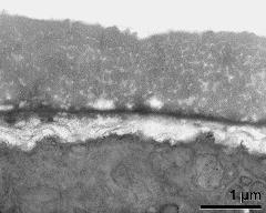 interapertural area of pollen wall